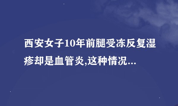 西安女子10年前腿受冻反复湿疹却是血管炎,这种情况还能被治愈吗?