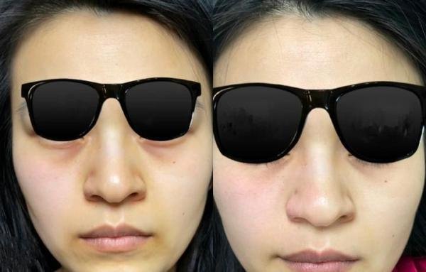 CJ小白瓶到底好用吗？真人不是托，三个月亲身实测！