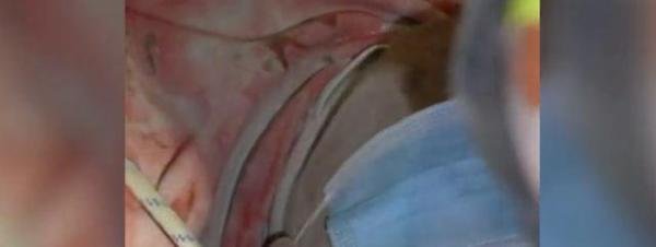 第10名幸存者被救出：“我一直有个信念，你们会来救我的！”