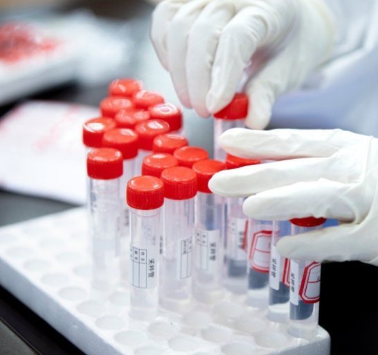 张家口一男子为泄愤强行拿走14管核酸标本，警方对其做出了怎样的处罚？