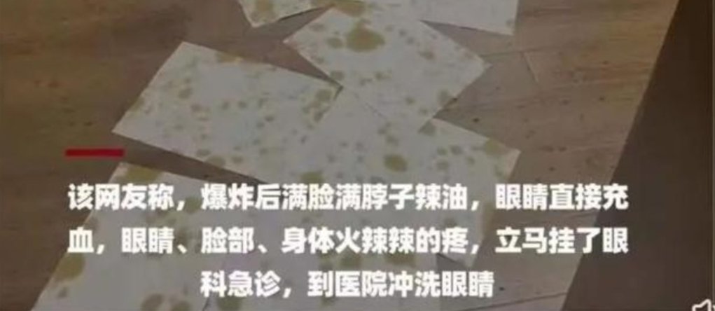 关于大学生被炸伤眼睛这件事，海底捞是如何回应的？