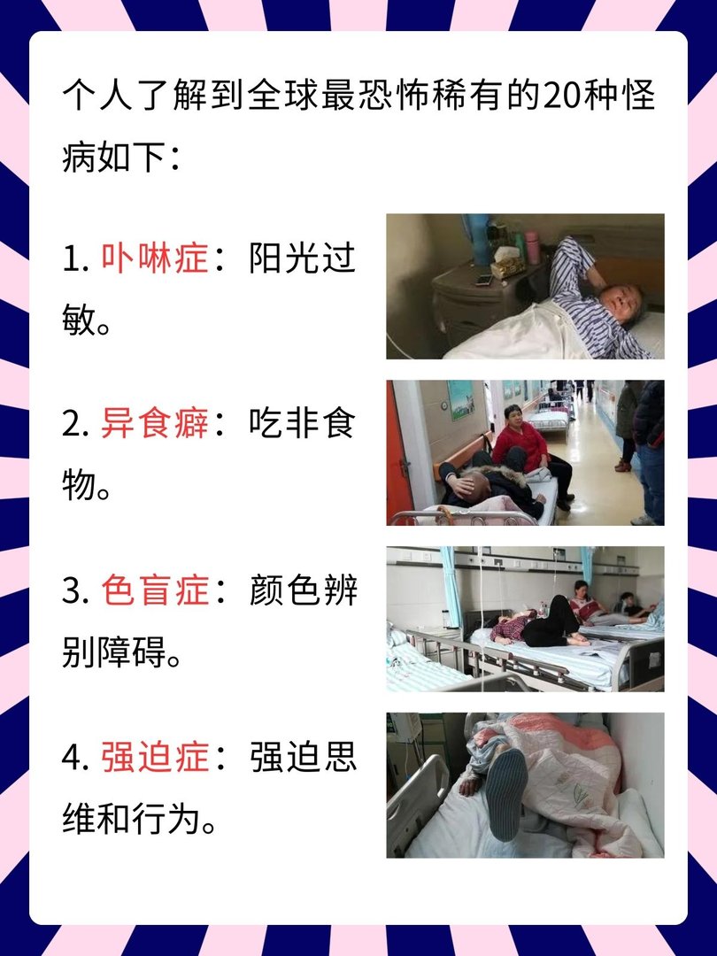 全球最恐怖稀有的20种怪病