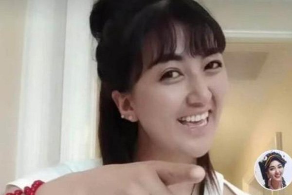 遭前夫纵火烧伤的网红拉姆,目前情况如何了,醒了吗?