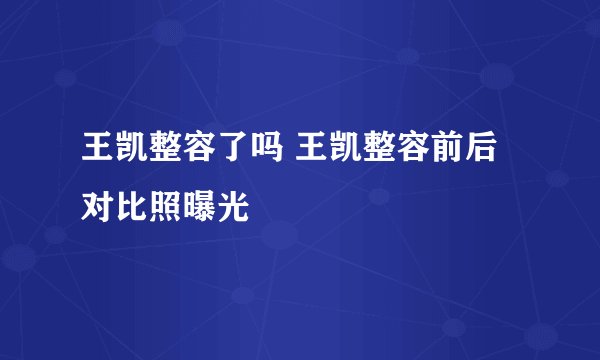 王凯整容了吗 王凯整容前后对比照曝光