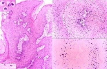 官方通报“两岁女童长菜花”：已排除性侵可能，为何网友却不买账？