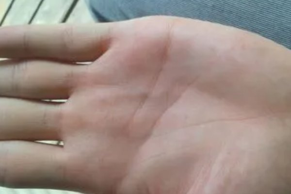 lifeline是什么意思