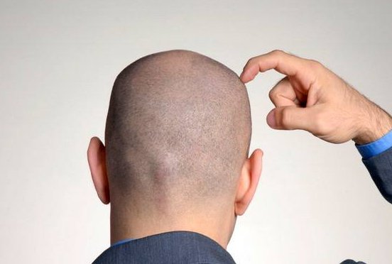 男子回应“不用洗发水变满头黑发”：清水洗头只是一方面，他还做了什么？