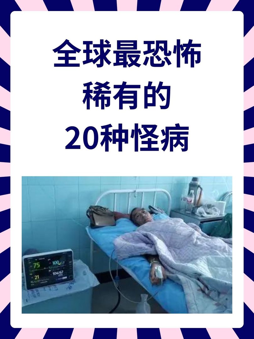 全球最恐怖稀有的20种怪病