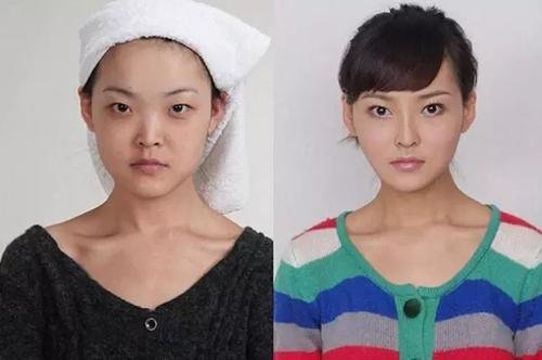 女子整容照片未打码在朋友圈流传，是否侵犯了个人隐私？