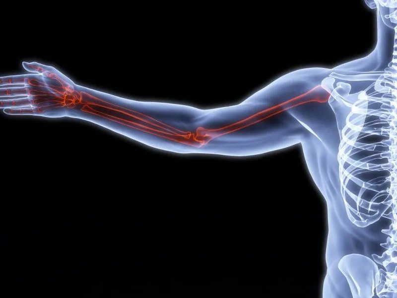 骨癌的前期症状表现