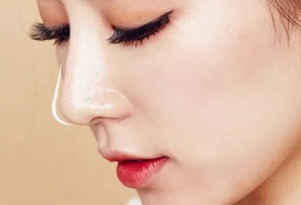 歪鼻矫正术费用