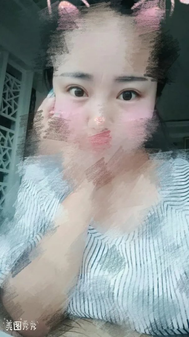 女子纹眉成熊猫眼，女生整形前都不考虑风险么？