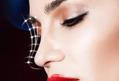 注射玻尿酸隆鼻价格