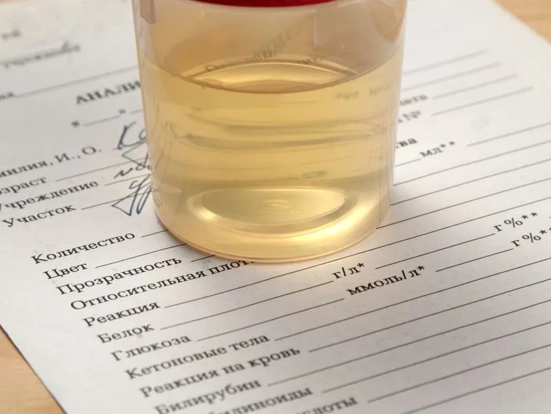 尿胆原偏高是什么原因