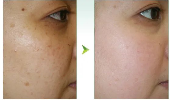 祛斑哪家医院好