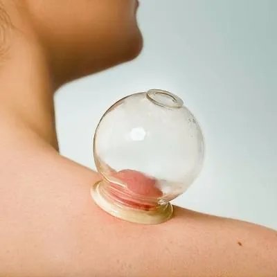 治疗牛皮癣吃什么药最好