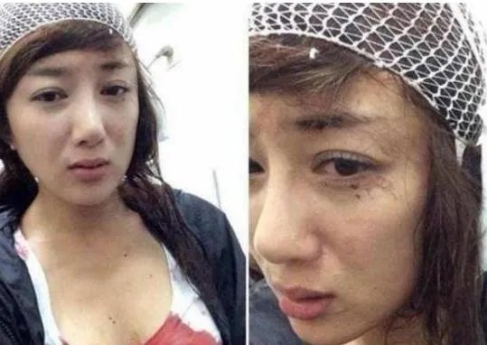 李依晓被叶璇狗咬事件怎么回事 李依晓被咬前后对比