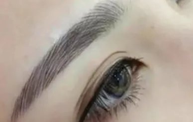 种植眉毛一般要多少钱