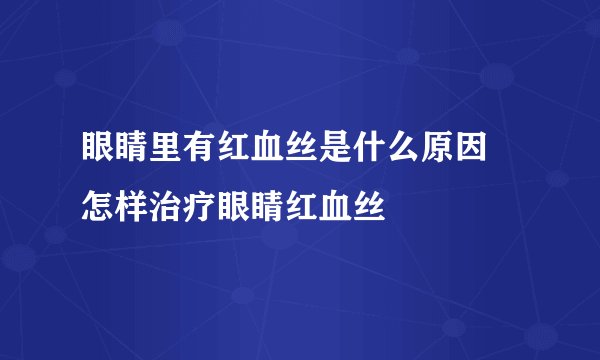 眼睛里有红血丝是什么原因 怎样治疗眼睛红血丝