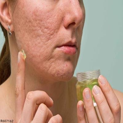 怎样可以祛痘坑