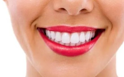 龅牙矫正多少钱