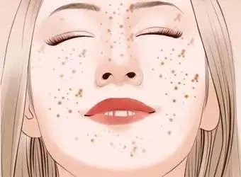 祛斑哪家医院好