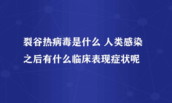 裂谷热病毒是什么 人类感染之后有什么临床表现症状呢