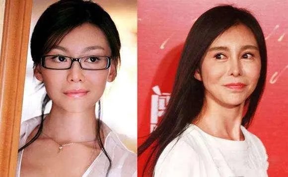 女子纹眉成熊猫眼，女生整形前都不考虑风险么？