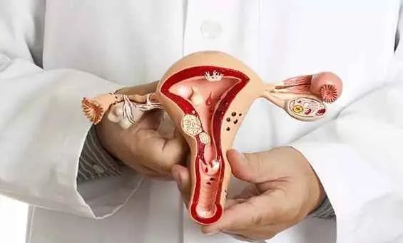 盆腔积液是怎么回事需要治疗吗？