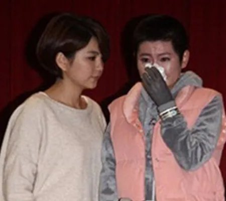 任家萱烧伤图片曝光  卸了妆的任家萱比Selina好看