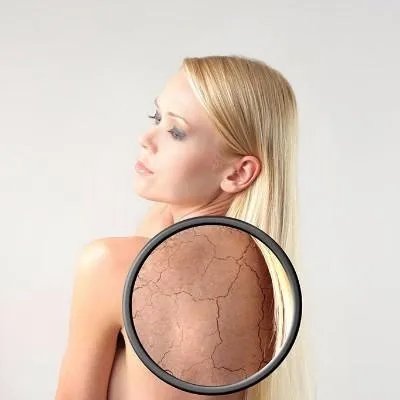 治疗牛皮癣吃什么药最好