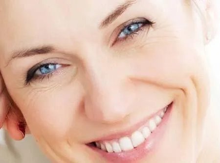 玻尿酸去法令纹的好处