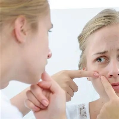 去青春痘疤痕怎么去除