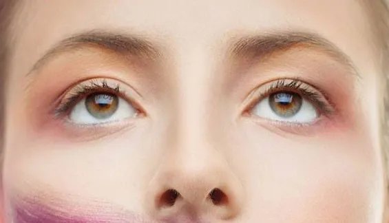 去除眼袋可以吗