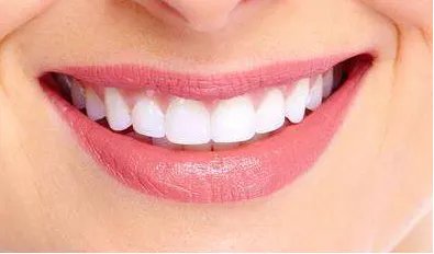 冷光美白牙齿大概需要多少钱