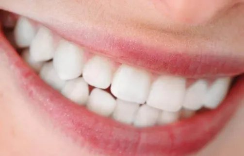 冷光美白牙齿的价格