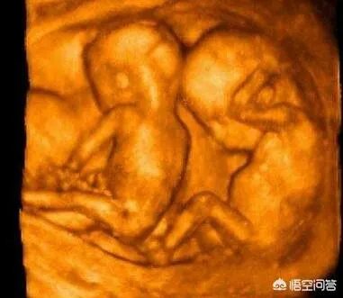 怀了双胞胎，他们会在妈妈肚子里打架吗？