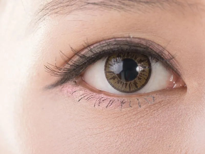 眼睛疾病有哪些