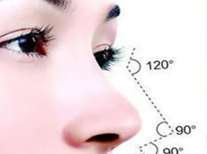 硅胶隆鼻费用是多少?