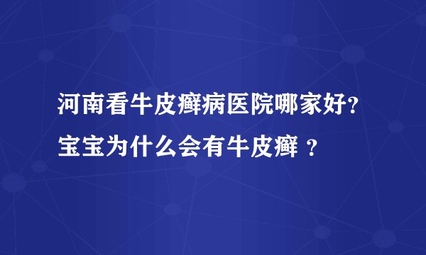 河南看牛皮癣病医院哪家好？宝宝为什么会有牛皮癣 ？