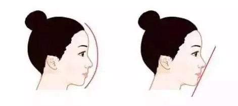 整容需要多少钱