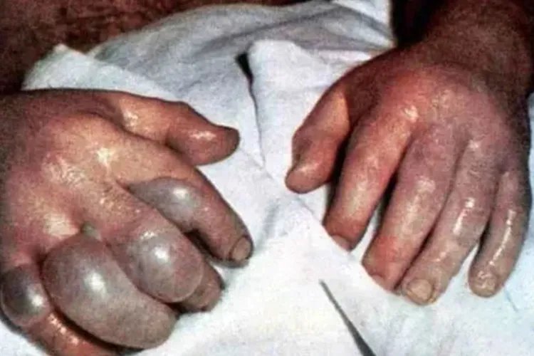 核辐射人体后的图