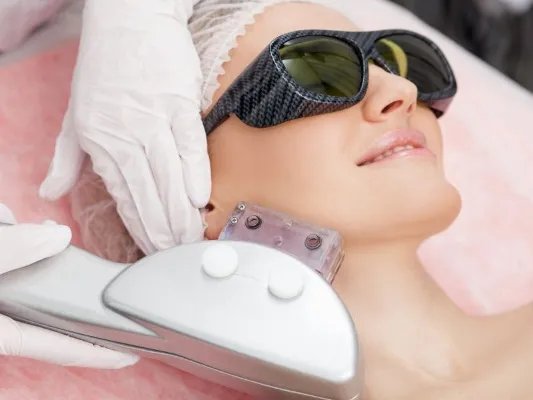 激光去斑会反弹吗