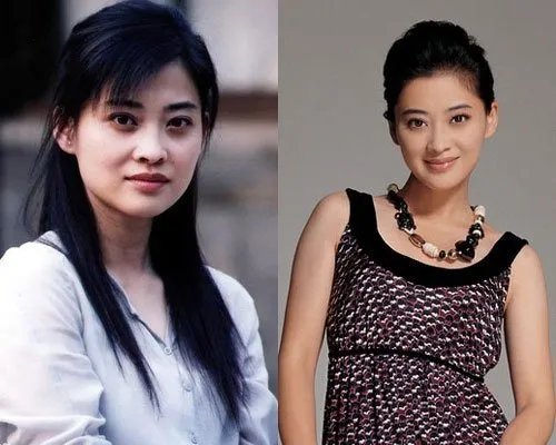 梅婷整容前后对比照惊人 曝老公被李小冉抢走