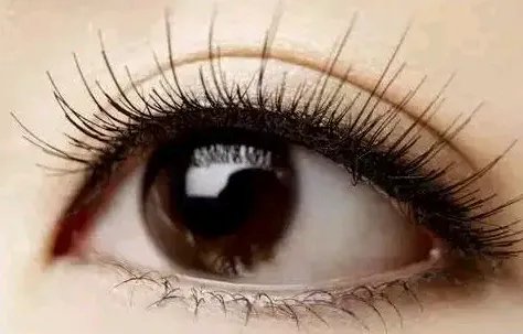 重庆做双眼皮费用