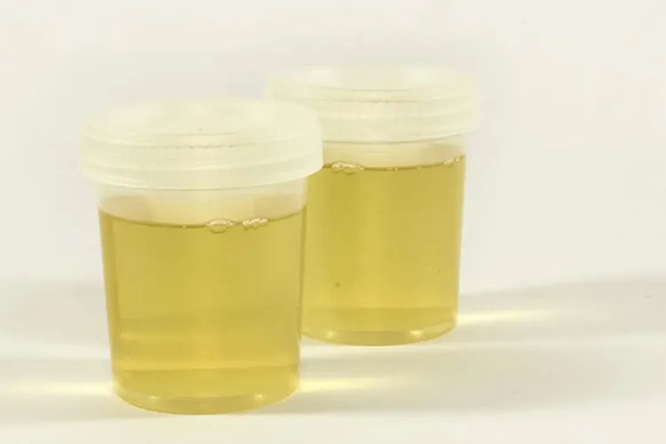 正常人的尿液图片