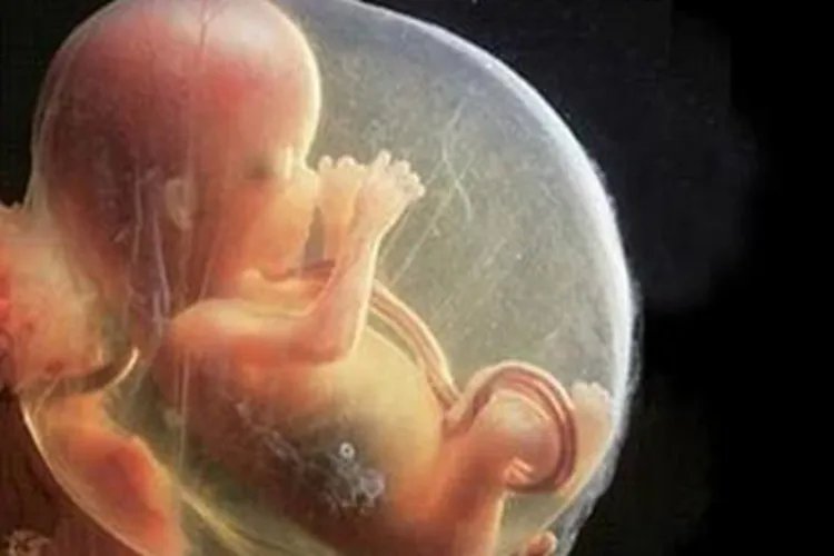 怀孕4个月胎儿图片