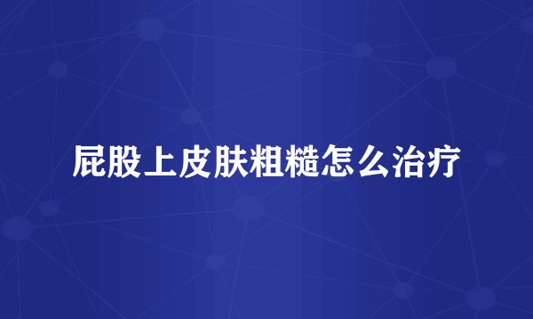 屁股上皮肤粗糙怎么治疗