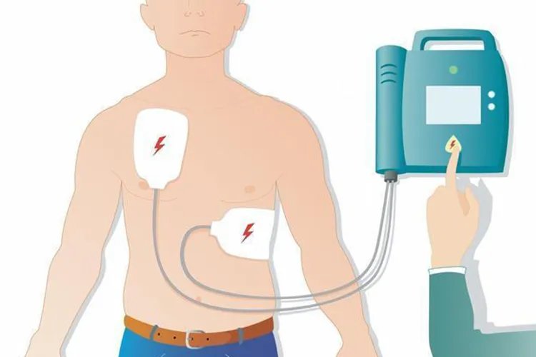 除颤仪的位置及图片