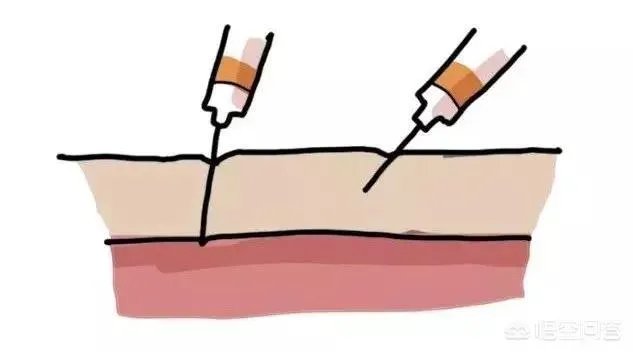 孩子害怕打针，家长如何帮助孩子克服恐惧心理？